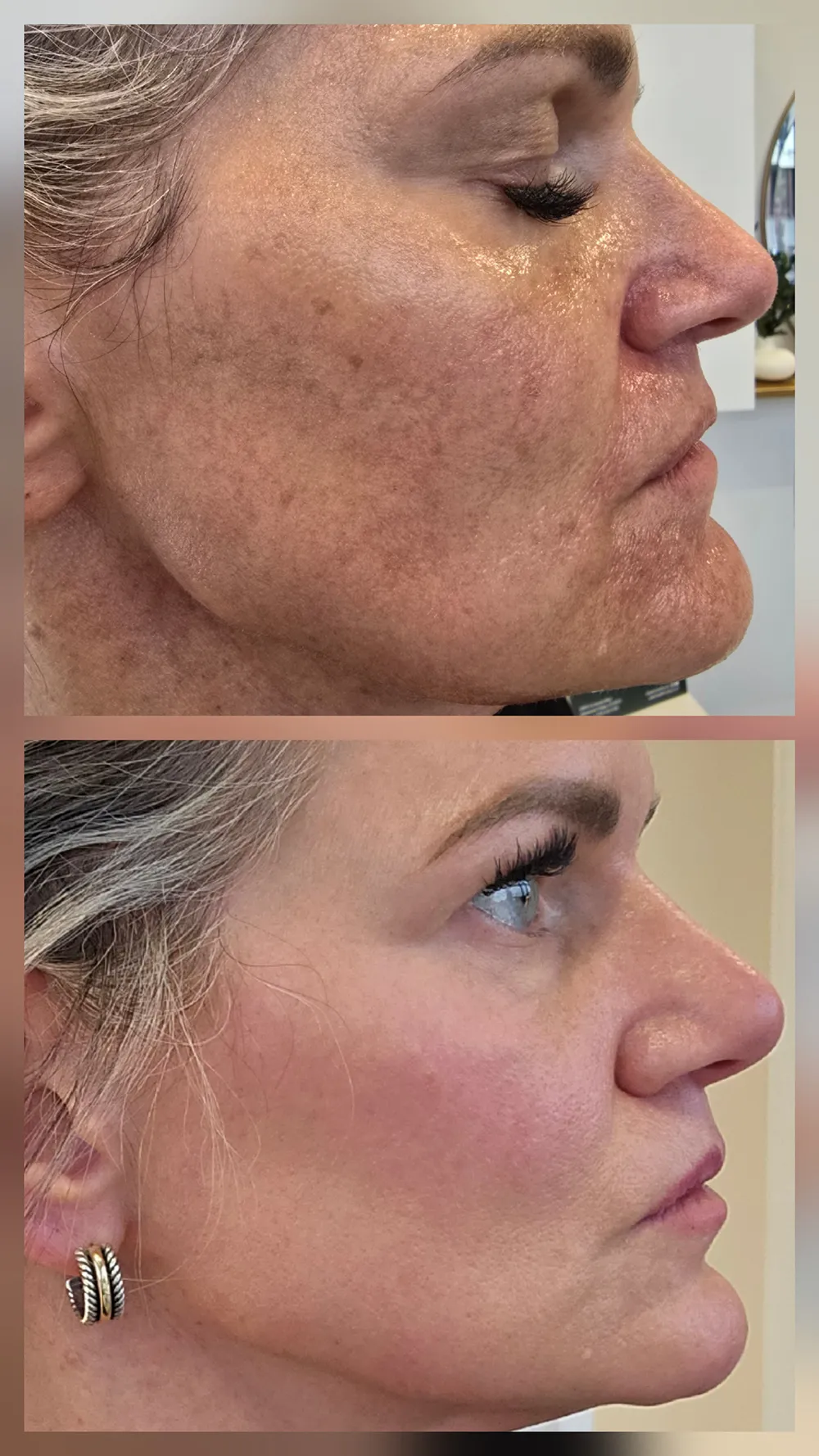 bbl-heroic-left-full