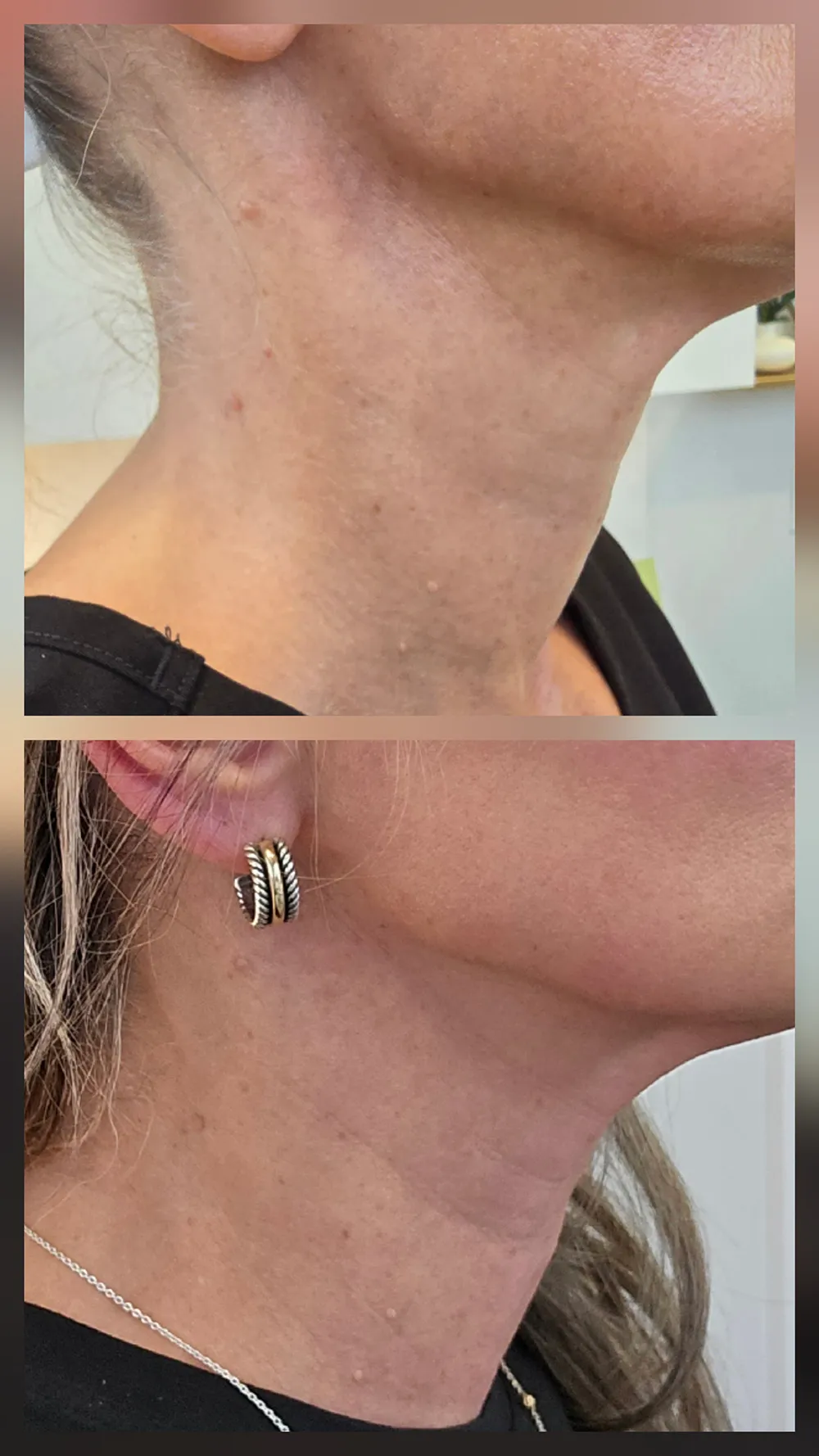 bbl-heroic-left-zoom