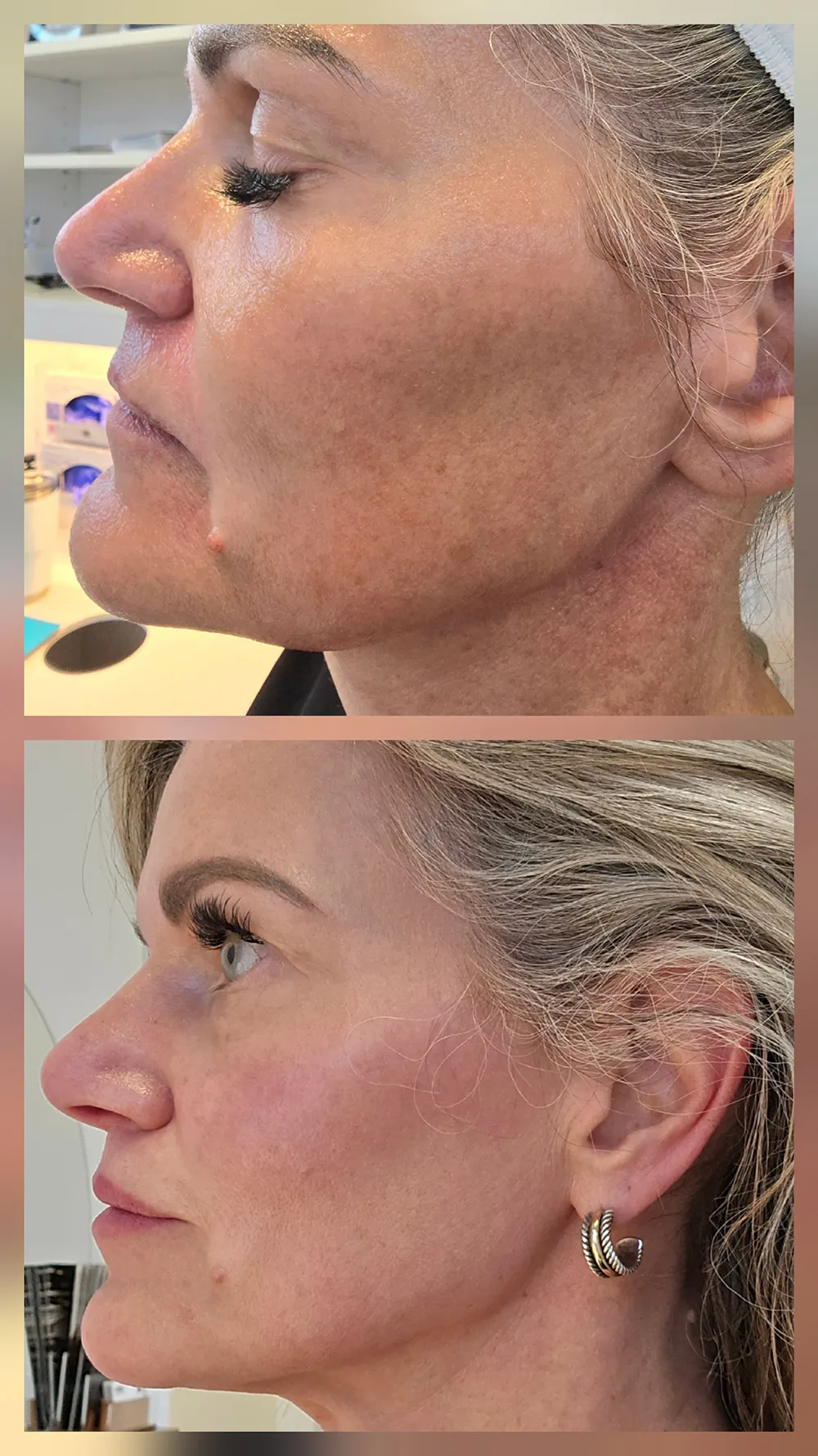 bbl-heroic-right-full