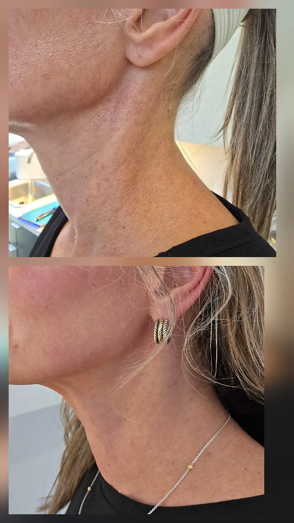 bbl-heroic-right-zoom